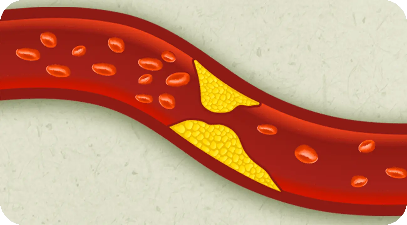 Devi controllare lo stato delle tue arterie? Ecco l’esame indolore che ti salva la vita
